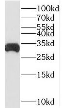 BDH1 Rabbit Polyclonal Antibody