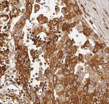 BDH1 Rabbit Polyclonal Antibody