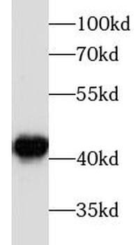 beta actin Mouse Monoclonal Antibody