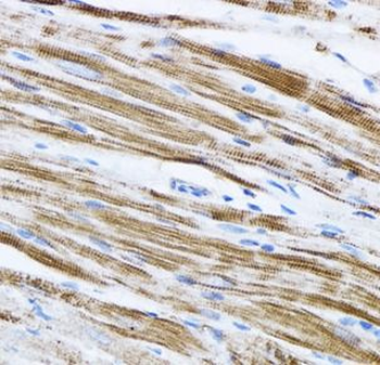 beta actin Mouse Monoclonal Antibody