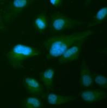 ARRB1 Rabbit Polyclonal Antibody