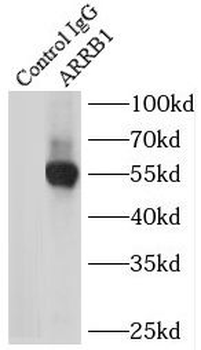ARRB1 Rabbit Polyclonal Antibody