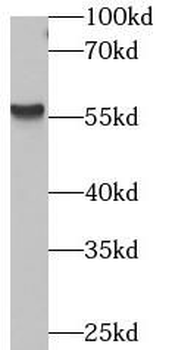ARRB1 Rabbit Polyclonal Antibody