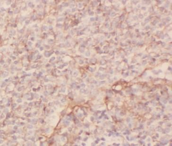 ARRB1 Rabbit Polyclonal Antibody