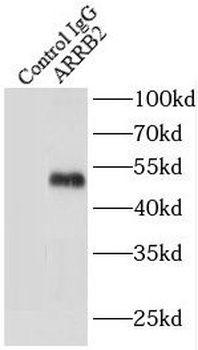 ARRB2 Rabbit Polyclonal Antibody