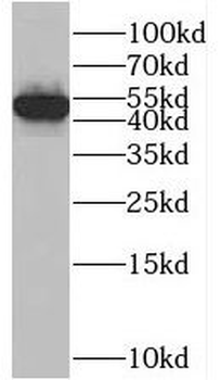 ARRB2 Rabbit Polyclonal Antibody