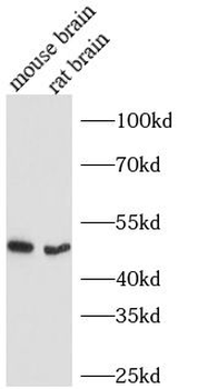 ARRB2 Rabbit Polyclonal Antibody