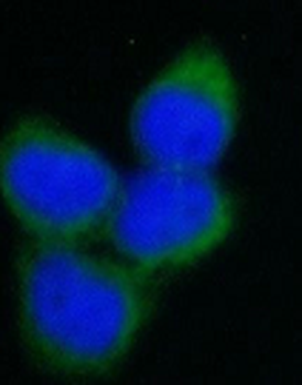 Beta Tubulin Rabbit Polyclonal Antibody