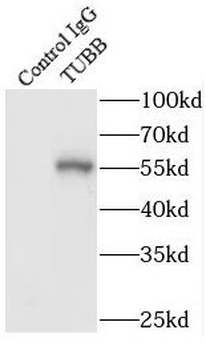 Beta Tubulin Rabbit Polyclonal Antibody