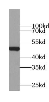 Beta Tubulin Rabbit Polyclonal Antibody