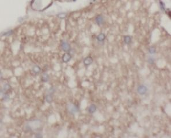 Beta Tubulin Rabbit Polyclonal Antibody
