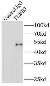 Beta Tubulin Rabbit Polyclonal Antibody