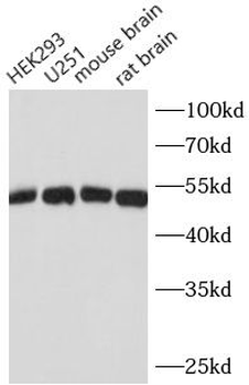 Beta Tubulin Rabbit Polyclonal Antibody