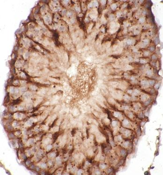 Beta Tubulin Rabbit Polyclonal Antibody