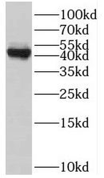 BGN Rabbit Polyclonal Antibody