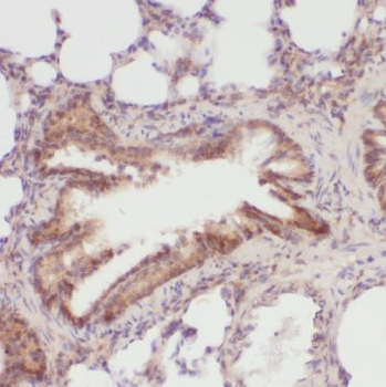 BGN Rabbit Polyclonal Antibody