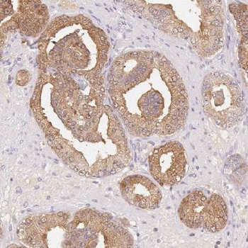 BIN3 Rabbit Polyclonal Antibody