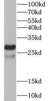 BIRC8 Rabbit Polyclonal Antibody