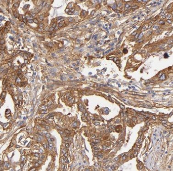 BLK Rabbit Polyclonal Antibody
