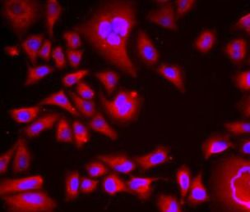 BLMH Rabbit Polyclonal Antibody