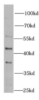 BLMH Rabbit Polyclonal Antibody