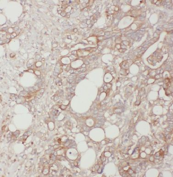 BLMH Rabbit Polyclonal Antibody