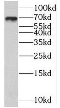 BLNK Rabbit Polyclonal Antibody
