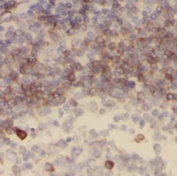 BLNK Rabbit Polyclonal Antibody