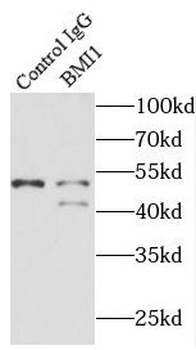 BMI1 Rabbit Polyclonal Antibody
