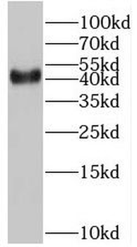 BMI1 Rabbit Polyclonal Antibody