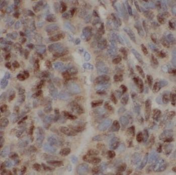BMI1 Rabbit Polyclonal Antibody