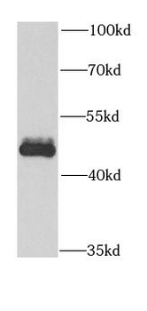 BMP3 Rabbit Polyclonal Antibody