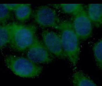 BMP7 Rabbit Polyclonal Antibody