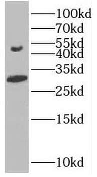 GDF2 Rabbit Polyclonal Antibody