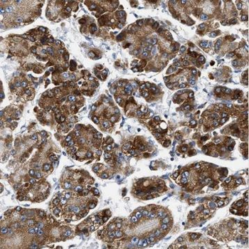 GDF2 Rabbit Polyclonal Antibody