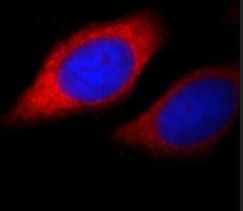 BMPR1A Rabbit Polyclonal Antibody