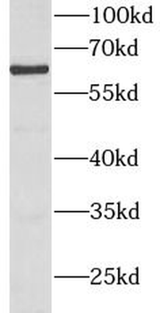 BMPR1A Rabbit Polyclonal Antibody