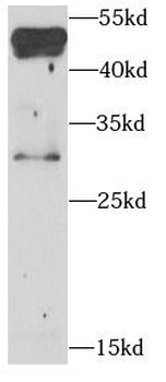 BNIP3L Rabbit Polyclonal Antibody