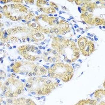 BNIP3L Rabbit Polyclonal Antibody
