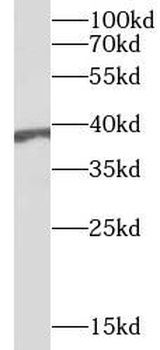 BPNT1 Rabbit Polyclonal Antibody