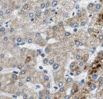 BPNT1 Rabbit Polyclonal Antibody