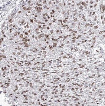 BRD7 Rabbit Polyclonal Antibody
