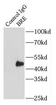 BABAM2 Rabbit Polyclonal Antibody