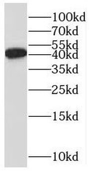 BABAM2 Rabbit Polyclonal Antibody