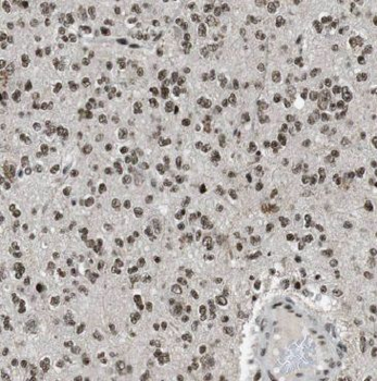 BABAM2 Rabbit Polyclonal Antibody