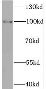 BRIP1 Rabbit Polyclonal Antibody