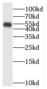 BTBD1 Rabbit Polyclonal Antibody