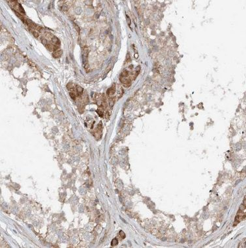 BTBD1 Rabbit Polyclonal Antibody