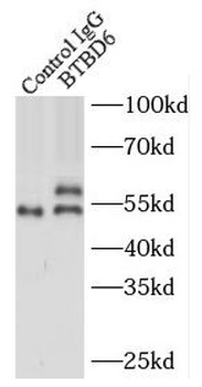 BTBD6 Rabbit Polyclonal Antibody