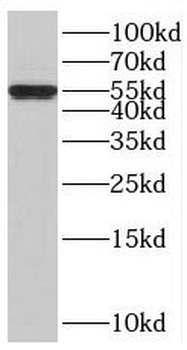 BTBD6 Rabbit Polyclonal Antibody